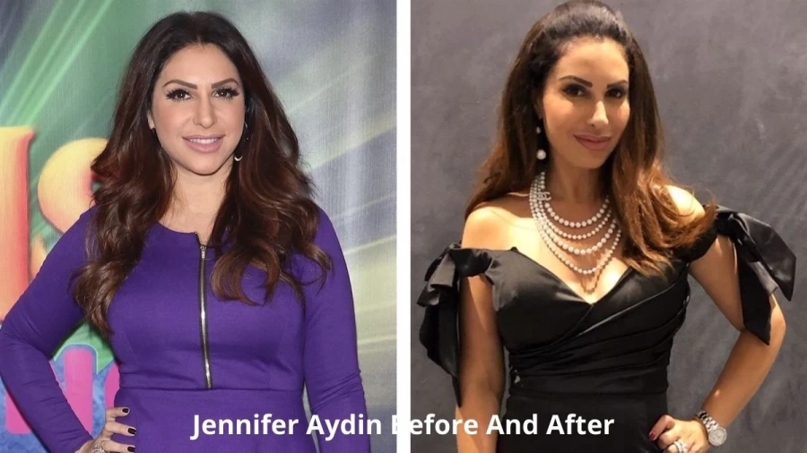 Jennifer Aydin Before And After, Get The Images Of Jennifer Aydin Before And After Plastic Surgery