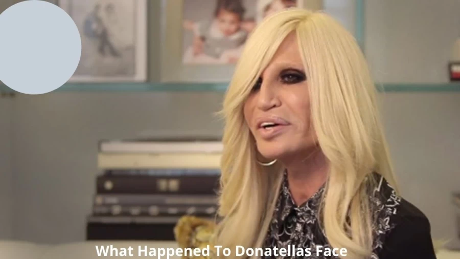 What Happened To Donatellas Face, Did Something Happened to Donatella Versaces Face?