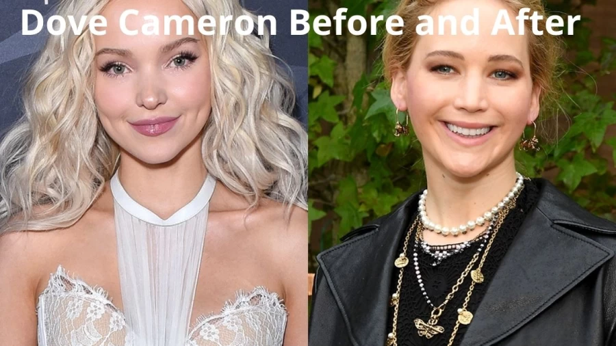 Dove Cameron Before And After, Who Is Dove Cameron? 