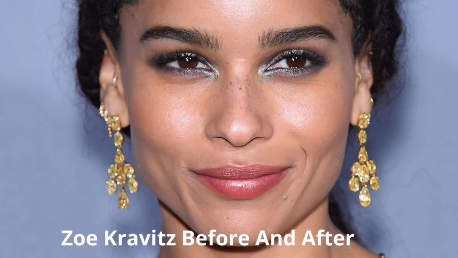 Zoe Kravitz Before And After, Who Is Zoe Kravitz? 