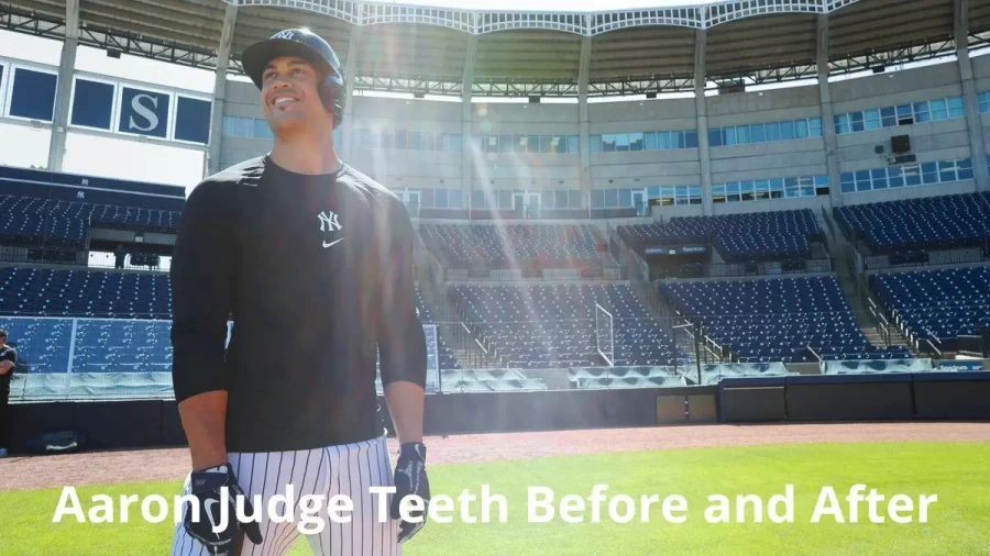 Aaron Judge Teeth Before And After, Did Aaron Judge Get His Teeth Done?