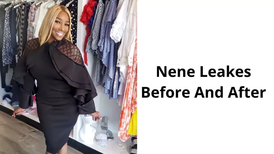 Nene Leakes Before And After, NeNe Leakes Plastic Surgery