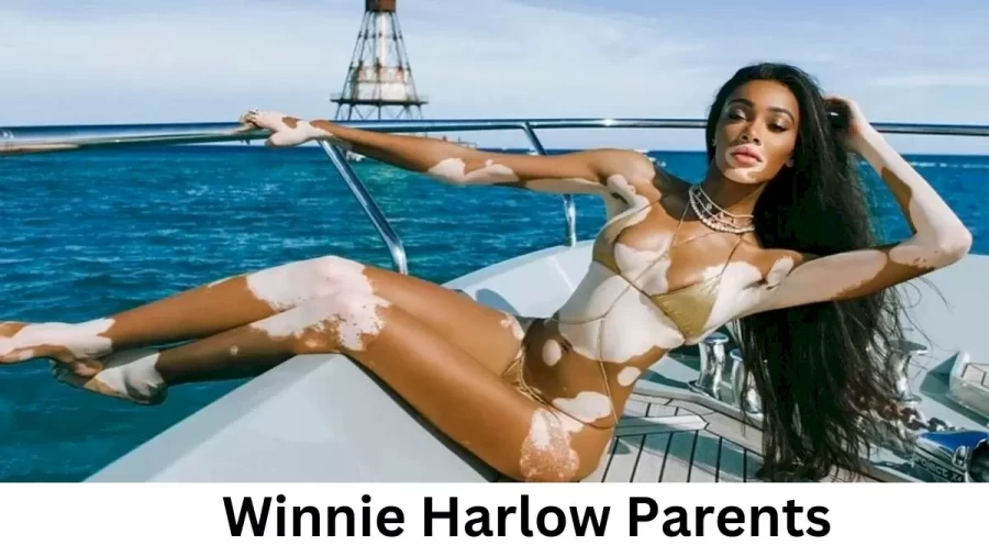 Who are Winnie Harlows Parents? Winnie Harlow Biography, Parents Name and More