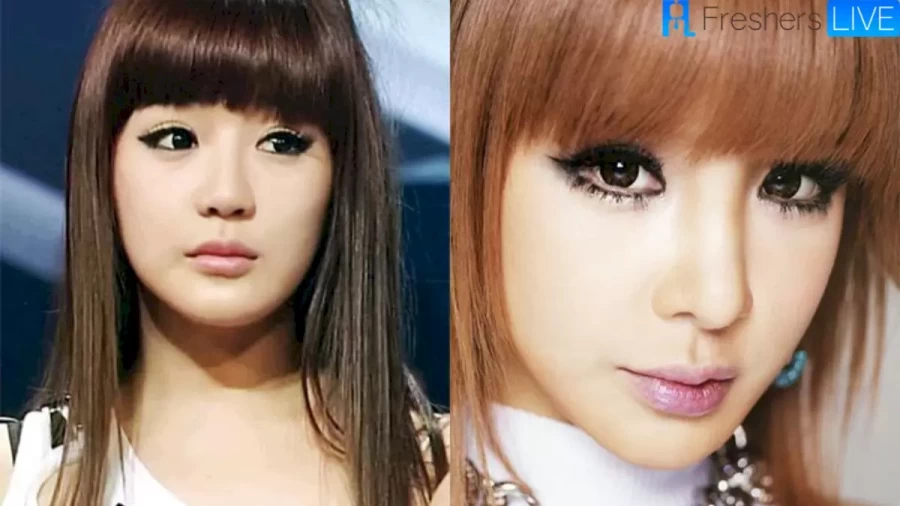 Park Bom Before Plastic Surgery: What Happened To Park Bom? Where Is Park Bom Now? What Disease Does Park Bom Has?